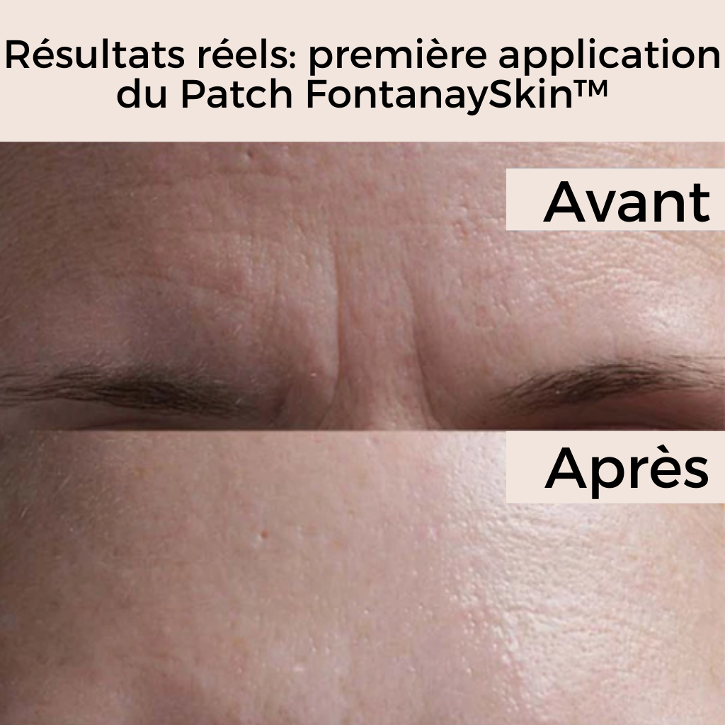 Patchs Anti-Rides Réutilisables