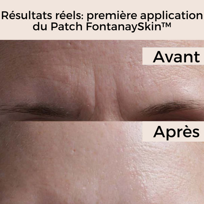 Patchs Anti-Rides Réutilisables